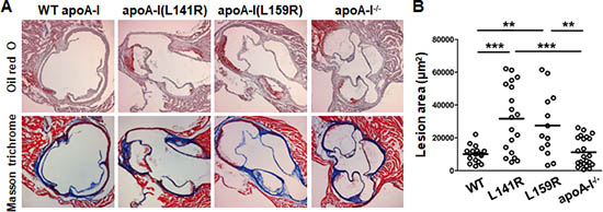 Atherosclerosis in Mice