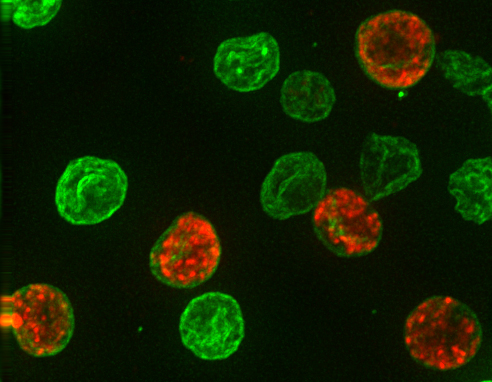 Plasmodium gametocytes (red) residing inside red blood cells (green) surrounded by non-infected red blood cells (green)