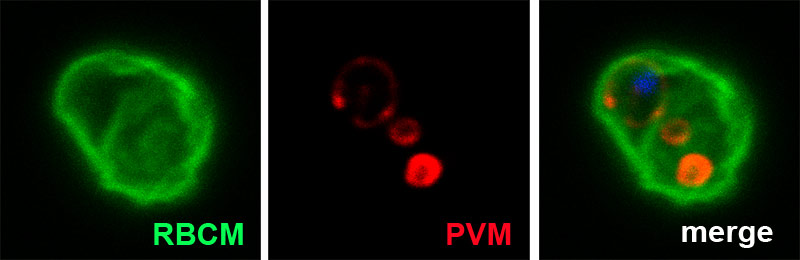 Gametocyte egress image